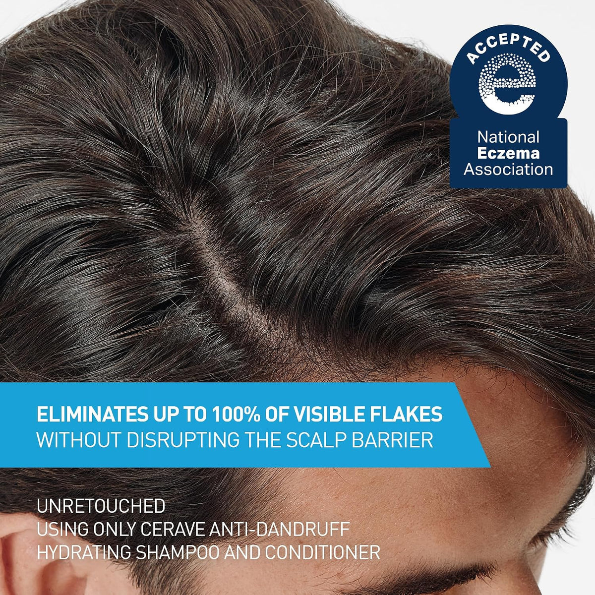 CeraVe Hydrating Anti Dandruff Shampoo. Itchy Scalp Treatment. 12oz | Helps Eliminate Flakes with 1% Pyrithione Zinc. Hyaluronic Acid. Niacinamide and Ceramides In Sulfate Free Formula
